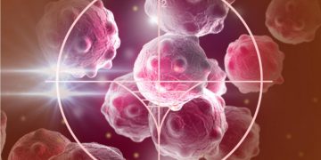 Καρκίνος: Αυτή η ανακάλυψη μπορεί να οδηγήσει στην θεραπεία όλων των μορφών του!