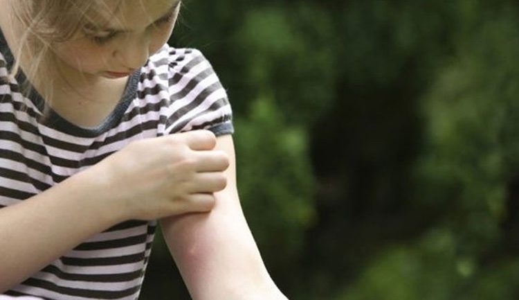 Πώς να προστατευτείτε από τα κουνούπια