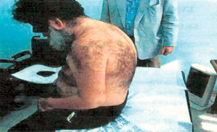 Ετσι είναι σήμερα ο Λαυρεντιάδης