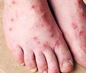 ΨΥΛΛΟΣ – Απίστευτο έντομο!