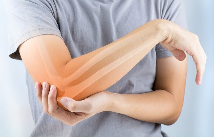 Ρευματοειδής αρθρίτιδα: Ποιες γυναίκες διατρέχουν μεγαλύτερο κίνδυνο