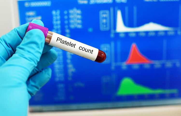 Τα αυξημένα αιμοπετάλια ισχυρή ένδειξη για καρκίνο