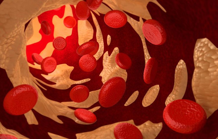 Χοληστερόλη LDL, HDL, VLDL, ολική: Ποιες είναι οι φυσιολογικές τιμές