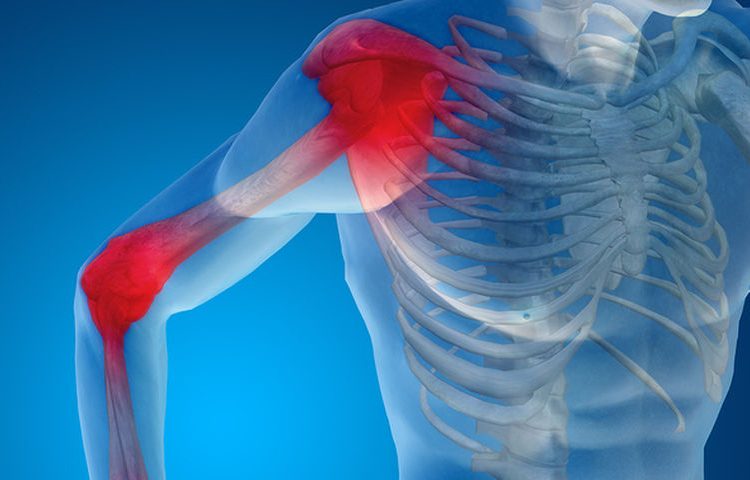 «Παγωμένος» ώμος: Ποια η σχέση του με τον διαβήτη