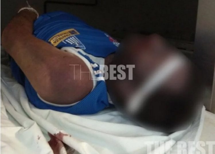 Πάτρα: Ξυλοκόπησαν κρατούμενο μέχρι θανάτου – Εικόνες σοκ
