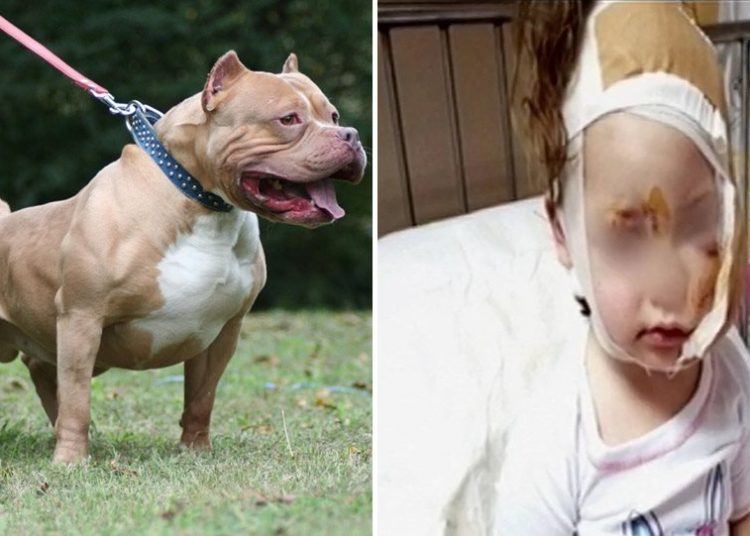 Πιτ μπουλ όρμησε και δάγκωσε κοριτσάκι στο πρόσωπο την ώρα που έλεγε τα κάλαντα