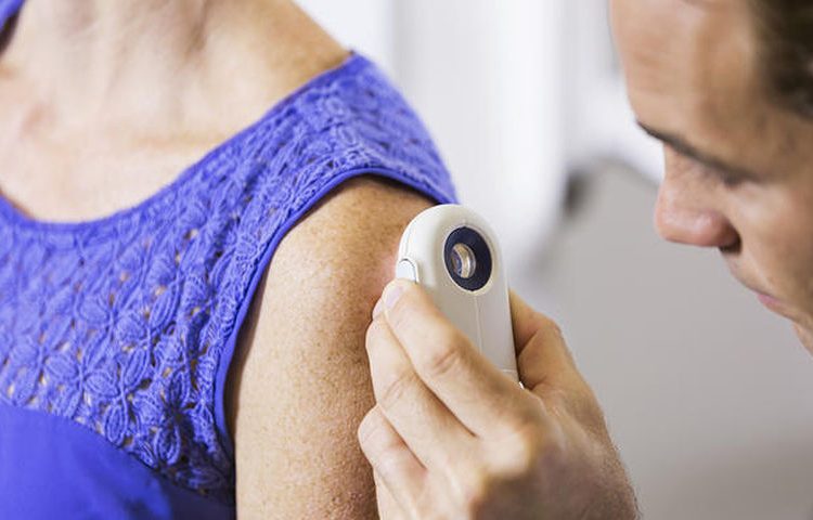 Καρκίνος του δέρματος: 4 άγνωστοι τρόποι προστασίας