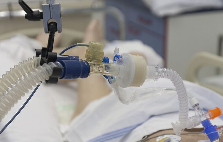 Διασωληνωμένος στην Πάτρα ο 60χρονος Εισαγγελέας που έπαθε πνευμονική εμβολή