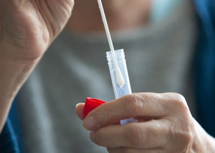 Διαθέσιμη από σήμερα η υπηρεσία της δήλωσης αποτελεσμάτων των self test