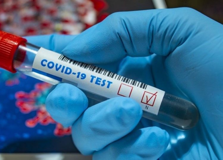 Κορωνοϊός: 406 νέα κρούσματα (κανένα η Ηλεία) – 16 θάνατοι, 277 οι διασωληνωμένοι  (22/6)