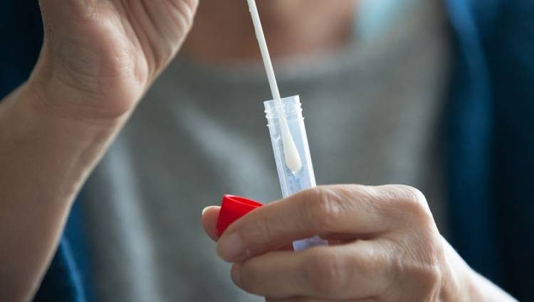 Φαρμακευτικός Σύλλογος Αχαΐας: Σταματά τη διάθεση self test!