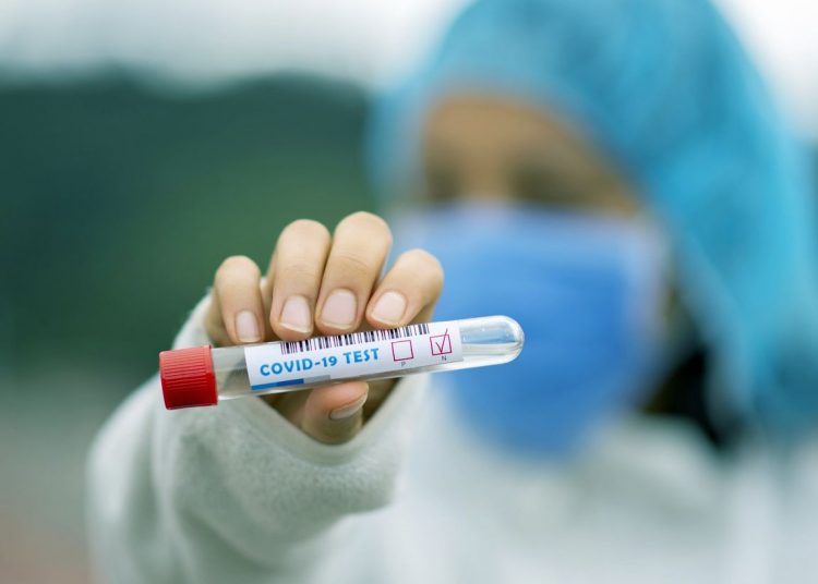 Νέα ράπιντ τεστ την Τετάρτη 23 Ιουνίου σε Κούμανι και Δίβρη