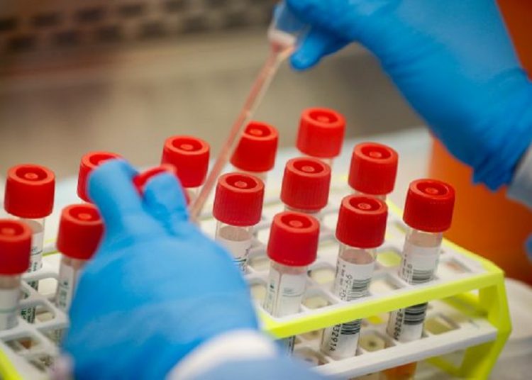 Κορονοϊός: 2.794 νέα κρούσματα (19 η Ηλεία) – 132 οι διασωληνωμένοι – 6 θάνατοι  (15/7)