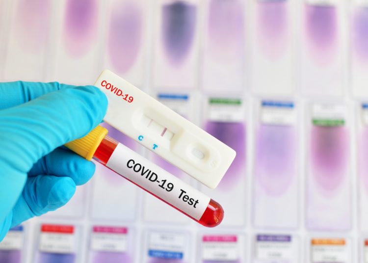 Ράπιντ τεστ τη Δευτέρα 2 Αυγούστου στην Αρχαία Ολυμπία