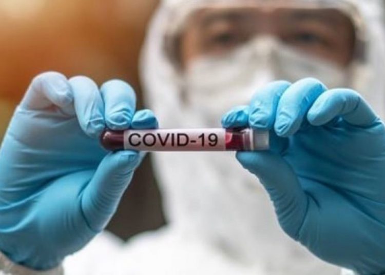 ΕΟΔΥ: Αποτελέσματα ελέγχων rapid test στην Ηλεία από 19/9 ως 24/9