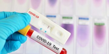 Κορωνοϊός: 2.919 νέα κρούσματα σε 348.000 τεστ! (27 η Ηλεία) – 31 θάνατοι – 369 οι διασωληνωμένοι  (14/9)