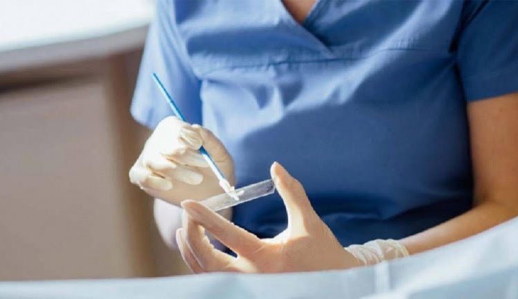 Μέλισσα Κυλλήνης: Δωρεάν τεστ Παπανικολάου για όλες τις γυναίκες  την Πέμπτη