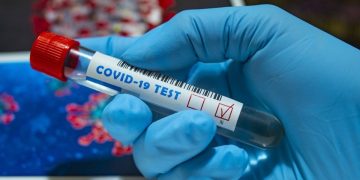 Κορωνοϊός: 2.831 νέα κρούσματα (23 η Ηλεία) – 91 θάνατοι – 662 οι διασωληνωμένοι  (19/12)