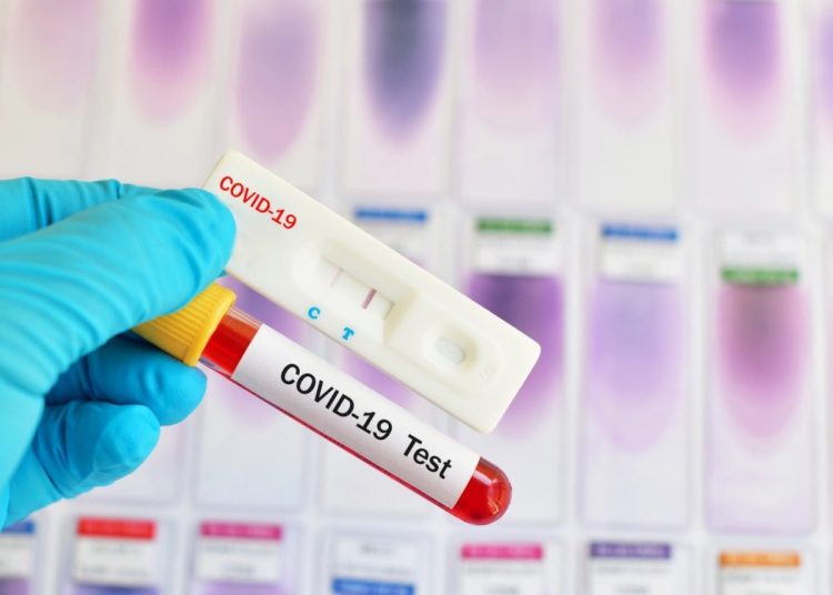 Κορονοϊός: 15.909 νέα κρούσματα (172 η Ηλεία) – 63 θάνατοι – 433 οι διασωληνωμένοι  (25/2)