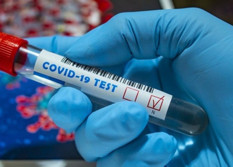 Κορονοϊός: 26.785 νέα κρούσματα (309 η Ηλεία) – 34 θάνατοι – 342 διασωληνωμένοι  (22/3)