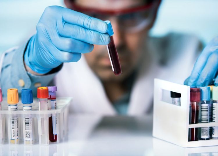 Aπεργούν τα διαγνωστικά εργαστήρια-Χωρίς δωρεάν εξετάσεις οι ασφαλισμένοι