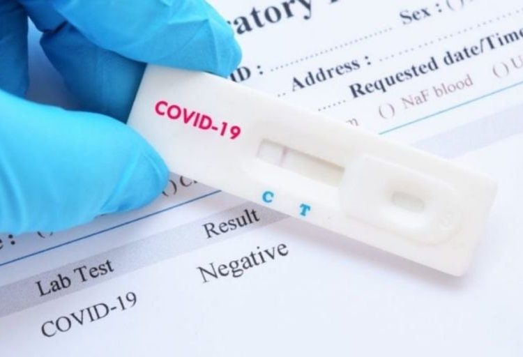 Ένα υποχρεωτικό rapid test την εβδομάδα για τους ανεμβολίαστους σε δημόσιο και ιδιωτικό τομέα