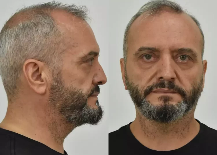 Κολωνός: Αυτός είναι ο 53χρονος που βίαζε και εξέδιδε τη 12χρονη