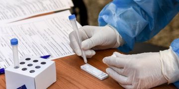 Δωρεάν rapid test στην Αμαλιάδα την Δευτέρα 16 Ιανουαρίου και την Τετάρτη 18 και την Παρασκευή 20 Ιανουαρίου