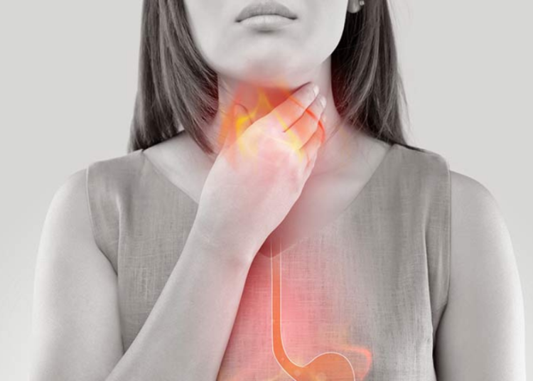 Γαστροοισοφαγική Παλινδρόμηση: Τα τρόφιμα που την επιδεινώνουν