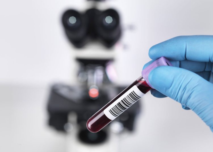 Προειδοποίηση ειδικών: Έρχεται «τσουνάμι» καρκίνων παγκοσμίως