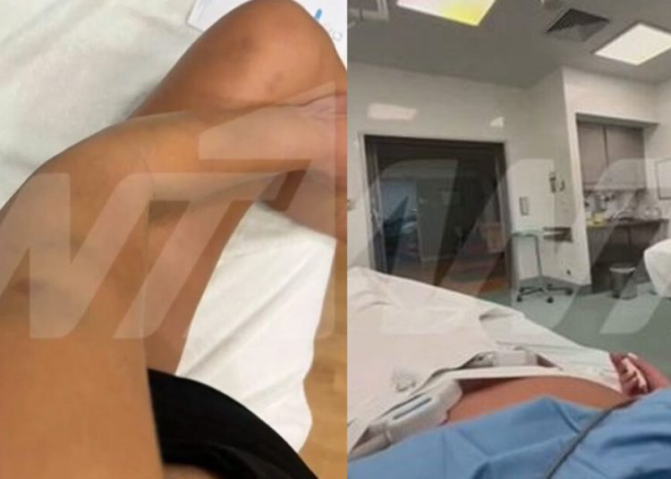 Γνωστός επιχειρηματίας κατηγορείται ότι ξυλοκόπησε την 27χρονη σύντροφό του στον 9ο μήνα της εγκυμοσύνης της