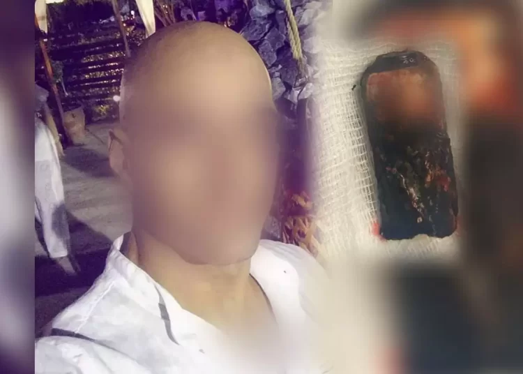 Επεισόδια στο Ρέντη: Με αυτή τη ναυτική φωτοβολίδα δέχθηκε δολοφονική επίθεση ο 31χρονος αστυνομικός