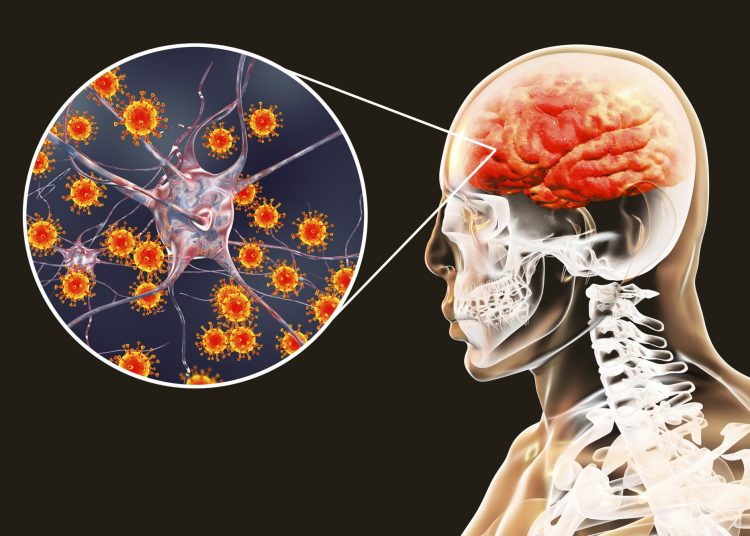 Μηνιγγίτιδα: 12 κρούσματα σε δύο μήνες-Τι να προσέξουμε