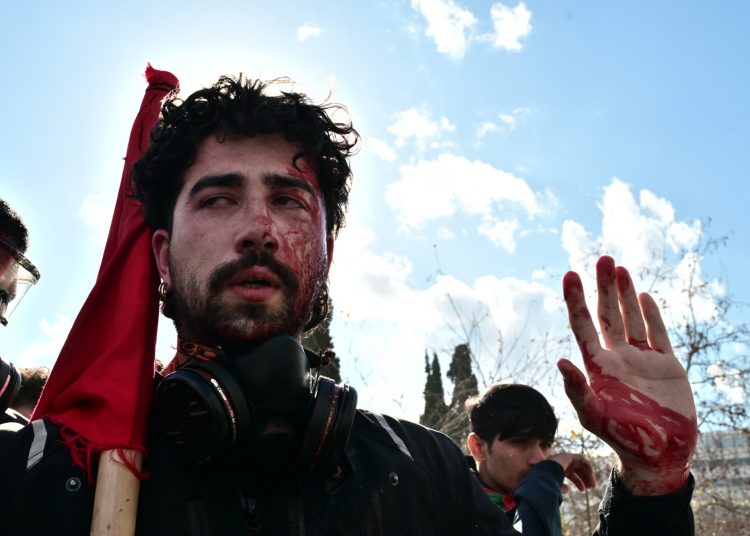 Eπίθεση αστυνομικών σε φοιτητές-Ανοιγμένα κεφάλια και αίματα