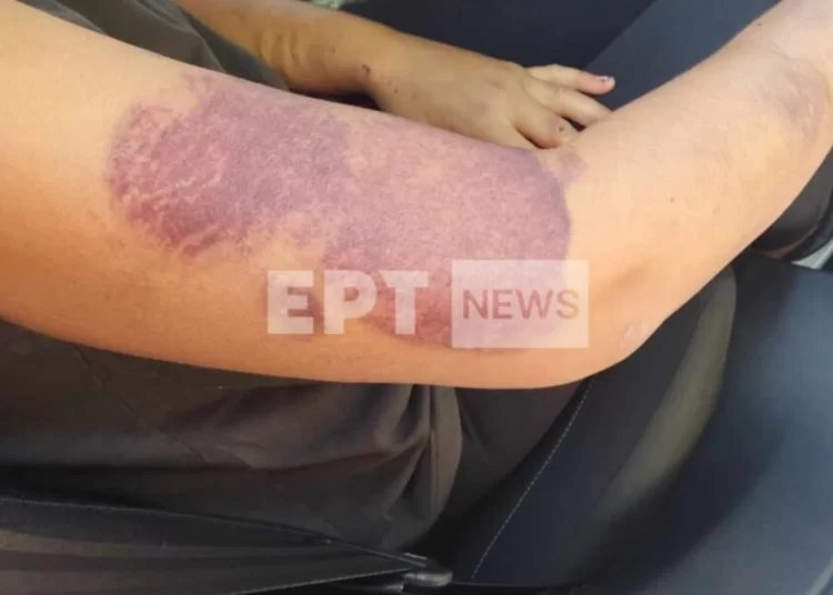 Διδυμότειχο: Σοκάρει η 32χρονη μητέρα 5 παιδιών για τον άνδρα που γνώρισε στο ίντερνετ – «Επί τρεις εβδομάδες με βίαζε!»