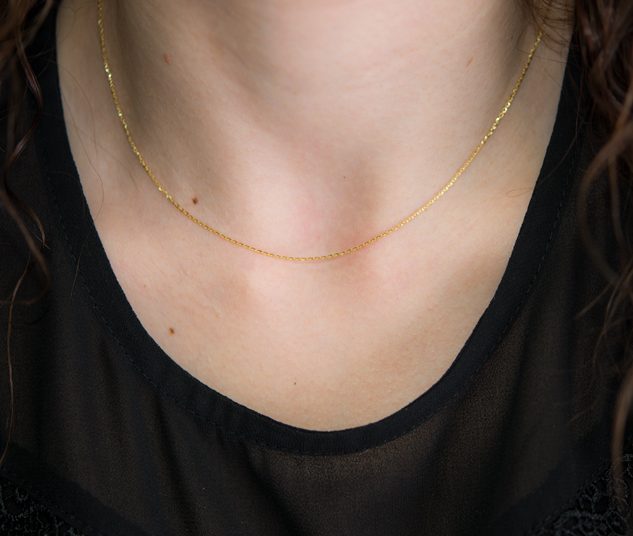 Πύργος: Βρήκε γυναίκα στον δρόμο, την αγκάλιασε και της πήρε αλυσίδα 1000 ευρώ