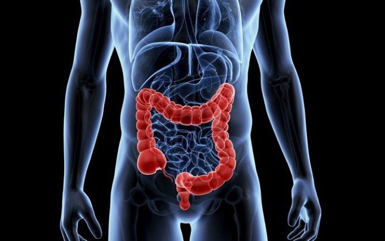 Καρκίνος παχέος εντέρου: «Θερίζει» στους κάτω των 40