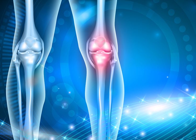 Οστεοαρθρίτιδα: Αυτή είναι η καλύτερη άσκηση για τον πόνο