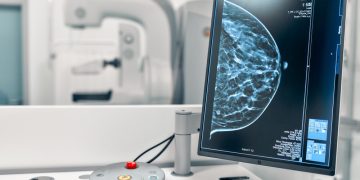 Δωρεάν μαστογραφία στον Δήμο Ολυμπίας από την Ελληνική Αντικαρκινική Εταιρεία