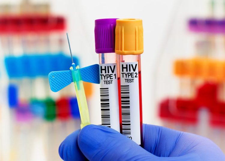 Υγεία-Ελλάδα: Ξεκίνησε η δωρεάν προφυλακτική αγωγή εναντίον του HIV