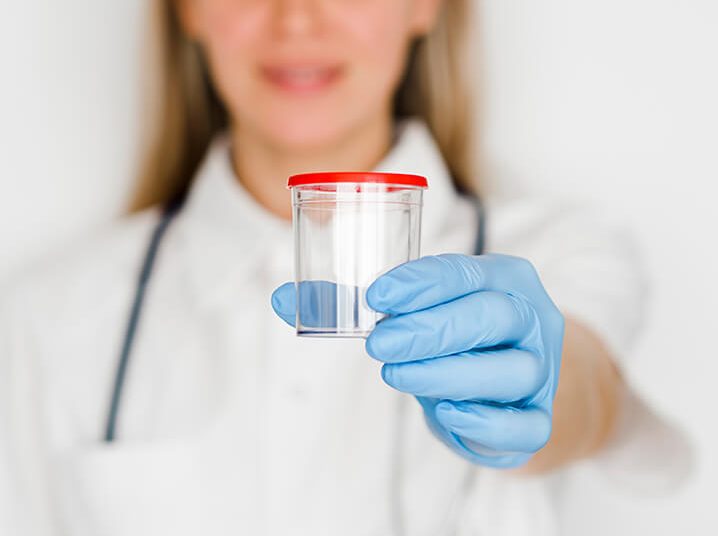 Πρωινά ούρα: Τι αποκαλύπτει το χρώμα τους για την υγεία