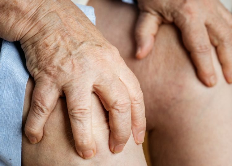 Αρθρίτιδα: Δύο ειδικοί λύνουν κάθε απορία για τη φλεγμονώδη νόσο